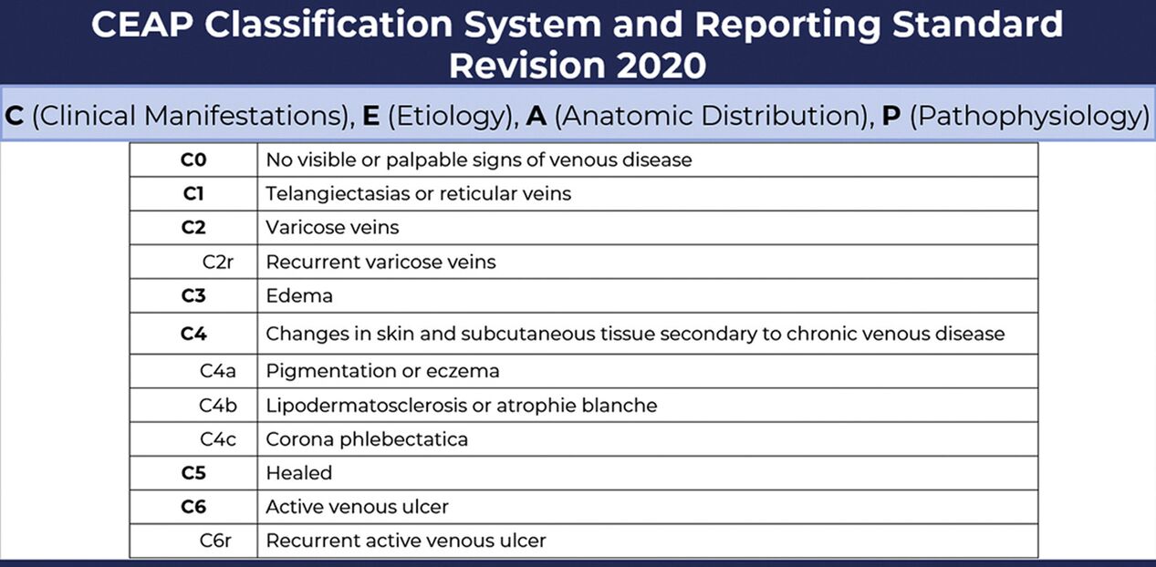 Stages of varicose veins according to the CEAP classification with amendments from 2020